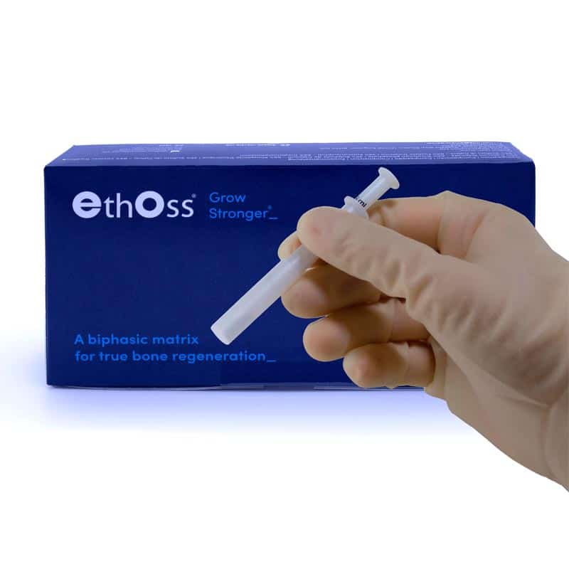 EthOss